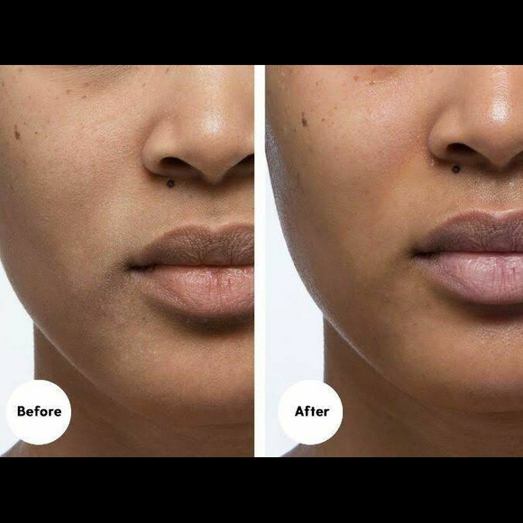 Peach and Lily Glass Skin Refining Serum - Picture 2 of 5